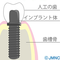 様々な治療方法　図