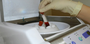 2. ガラス製の採血管を遠心分離機（MEDIFUGE）にセットし、スタートさせる　イメージ画像